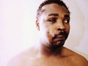 Rodney King (1965-2012) a bántalmazás után 1991-ben