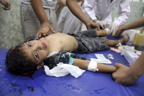 Palesztin kisfiút látnak el 2014. július 22-én